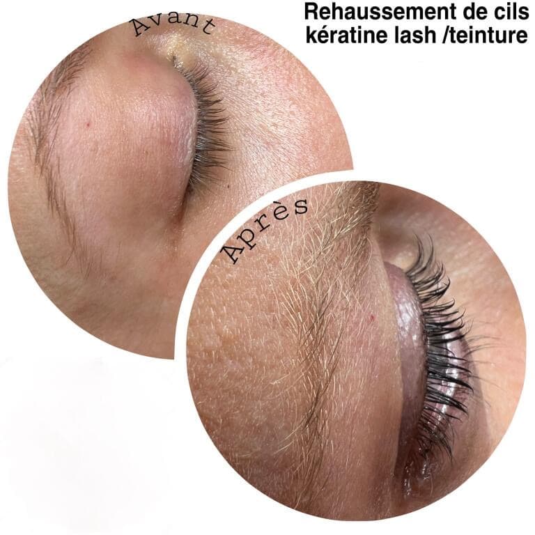 Réchauffement des cils Réchauffement des cils